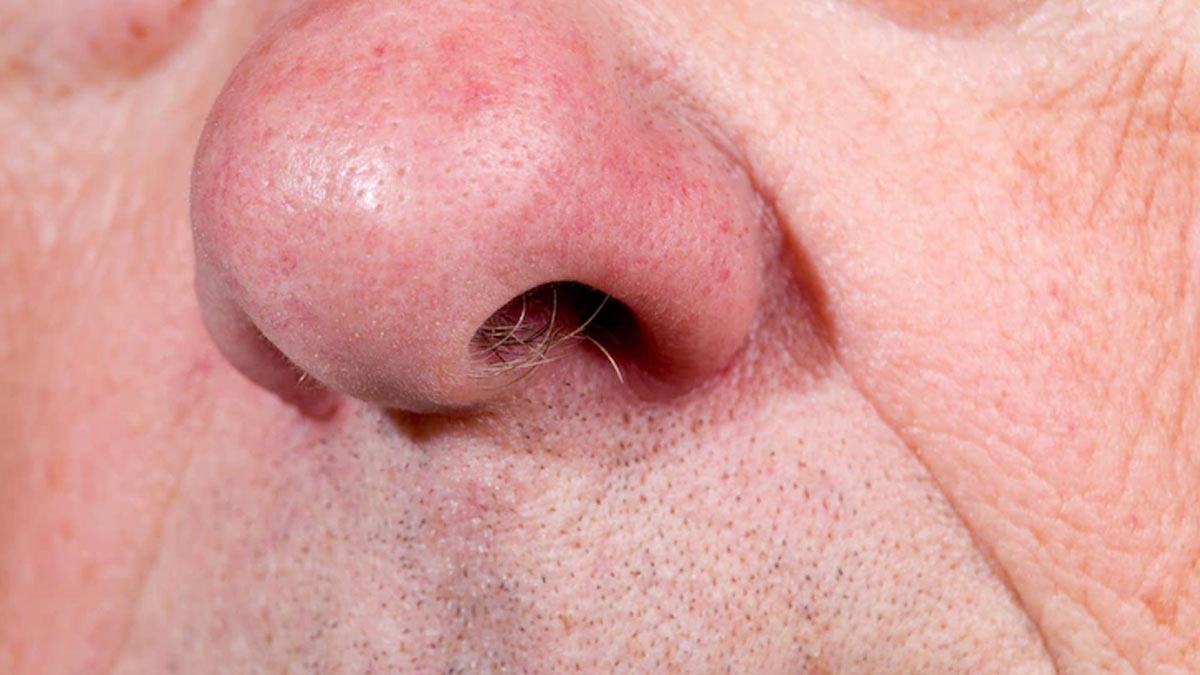 Nose Hair Benefits: Why You Should Not Remove It