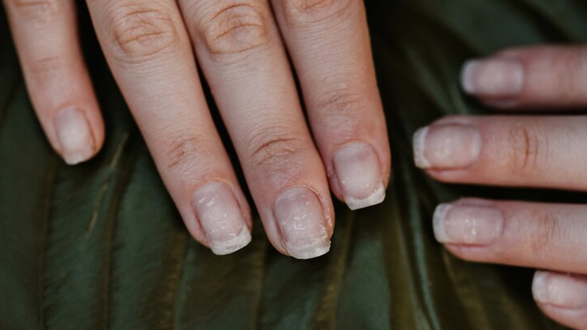 No half-moon on nails: What does it mean?