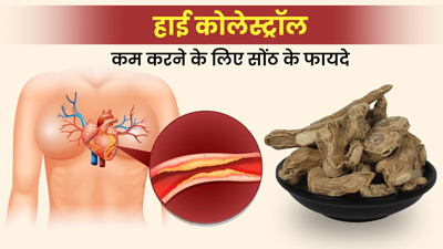 हाई कोलेस्ट्रॉल कम करने के लिए इस तरह से करें सोंठ का सेवन, मिलेंगे अनोखे फायदे