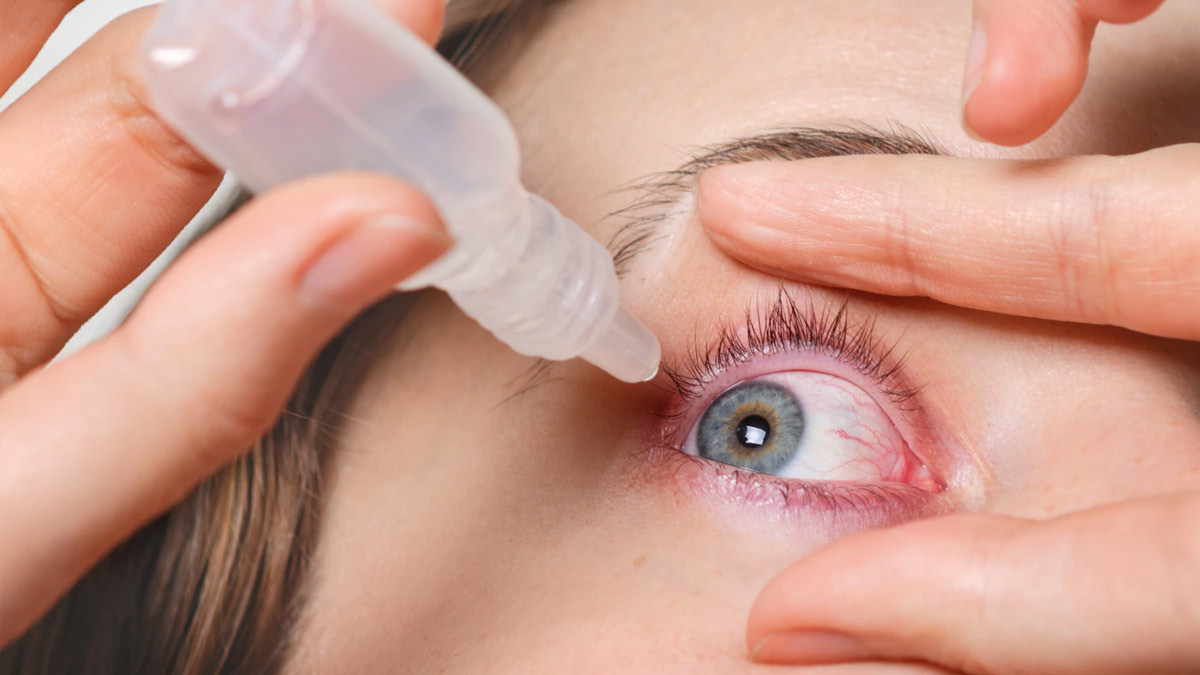 Constant Redness in Eyes Causes