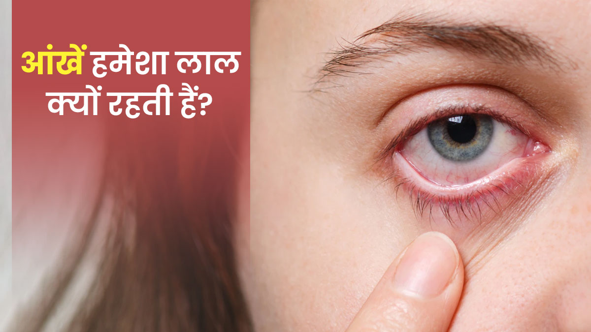 आंखें हमेशा लाल क्यों रहती हैं? जानें इसके कारण और बचाव के उपाय