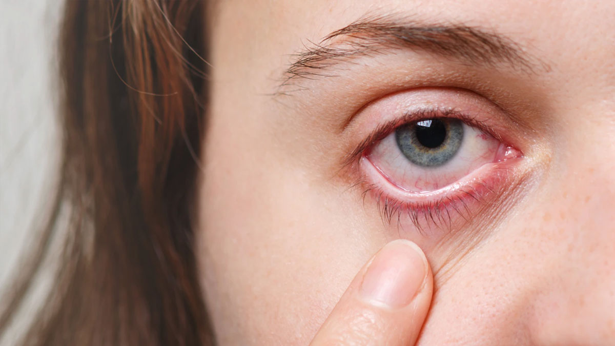 eye infection pregnancy 