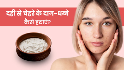दही से चेहरे के दाग-धब्बे कैसे हटाएं? जानें प्रयोग के 3 तरीके