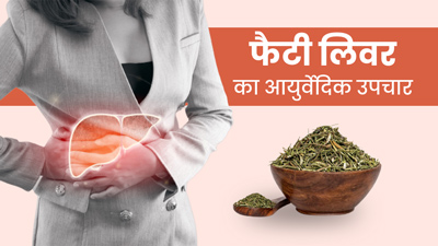 फैटी लिवर की समस्या को दूर करने के लिए आजमाएं ये 5 आयुर्वेदिक उपाय