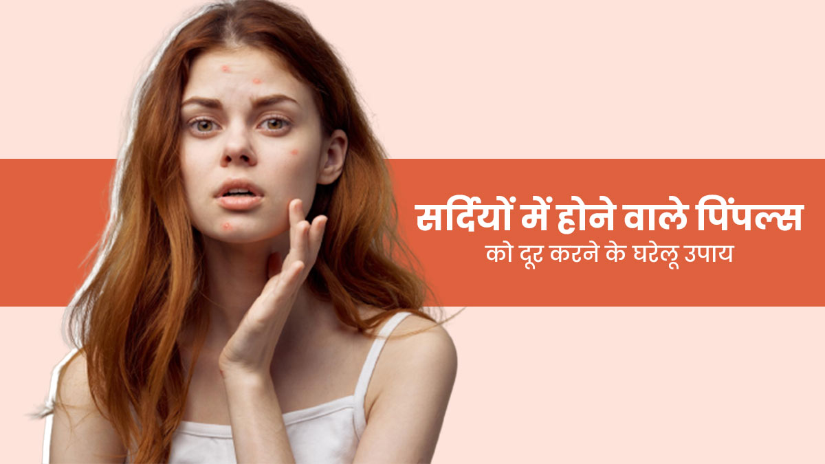 सर्दियों में होने वाले एक्ने-पिंपल्स कैसे हटाएं? जानें 5 आसान घरेलू उपाय