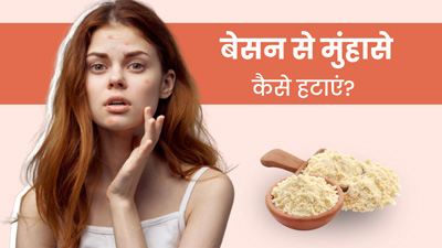 बेसन से पिंपल्स कैसे हटाएं? जानें 4 तरीके, जिनसे मिलेगा मुंहासों से छुटकारा