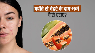 चेहरे के दाग-धब्बों को दूर करता है पपीता, जानें इस्तेमाल का तरीका
