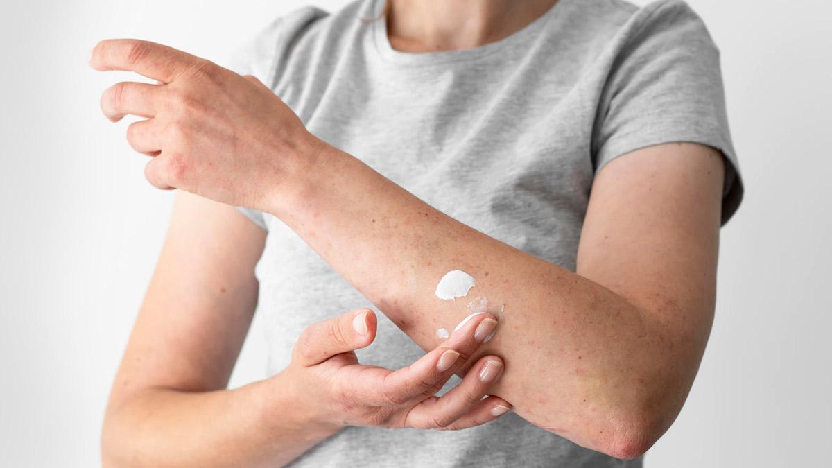 Symptoms on Skin Due to Vitamin D Deficiency