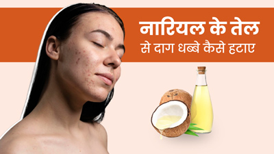 नारियल तेल से चेहरे के काले धब्बे कैसे हटाएं? जानें 3 तरीके, जिनसे मिलेंगी ग्लोइंग स्किन