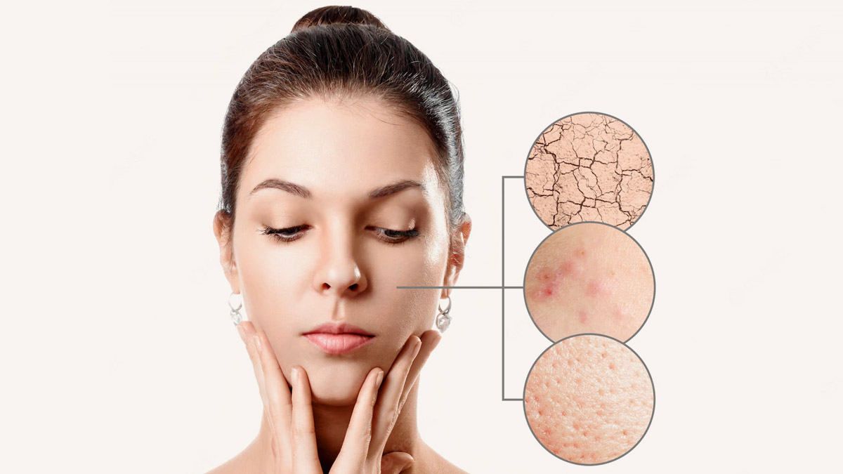 Coconut Oil For Dark Spots In Hindi