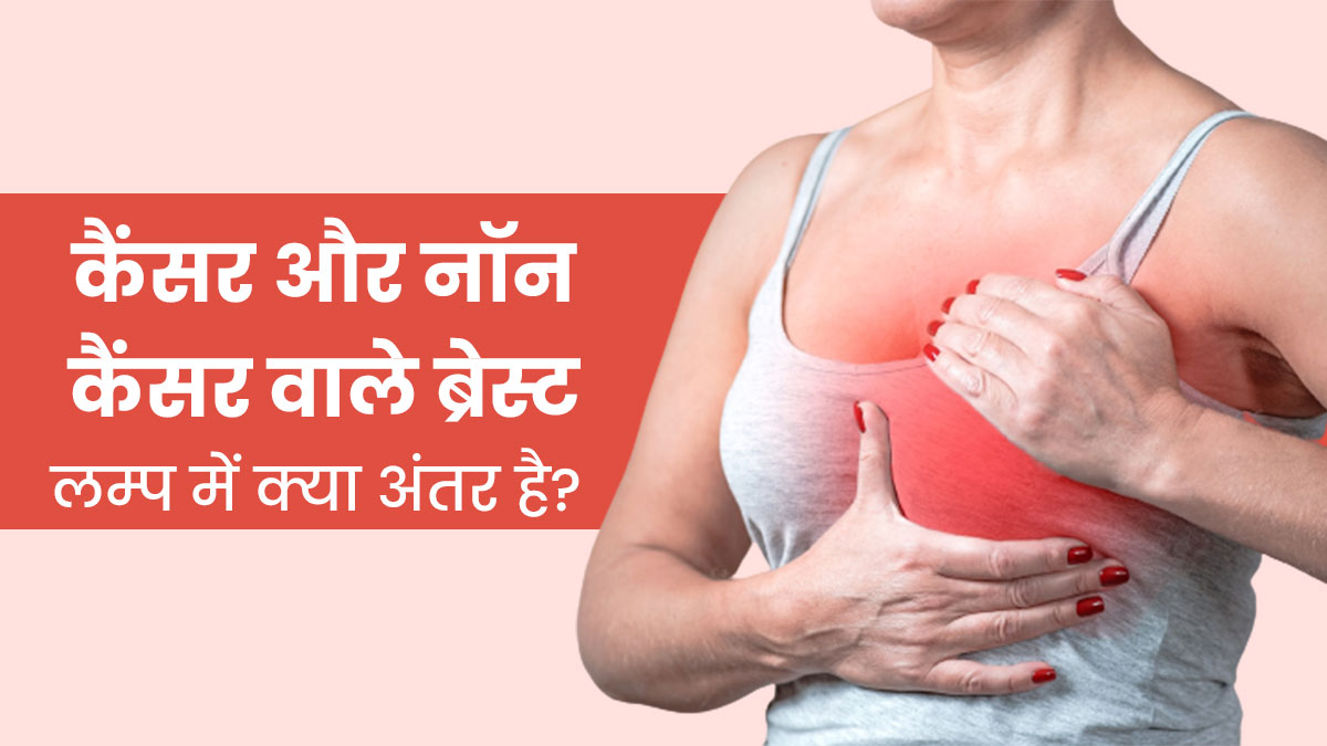 difference-between-cancer-breast-lump-and-cyst-in-hindi