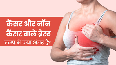 कैंसर और नॉन कैंसर वाले ब्रेस्ट लम्प में क्या अंतर है? जानें कैसे पहचानें
