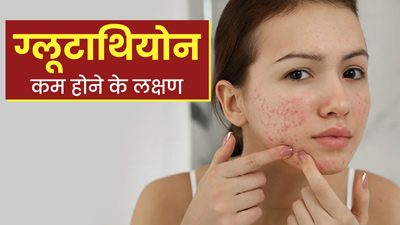 शरीर में ग्लूटाथियोन (Glutathione) कम होने पर दिख सकते हैं ये लक्षण, न करें नजरअंदाज