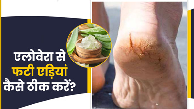 सर्दियों में एड़ियां फटने पर इन 5 तरीकों से लगाएं एलोवेरा, मुलायम बनेगी स्किन
