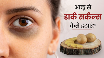 आलू से डार्क सर्कल कैसे हटाएं? जानें प्रयोग के 4 तरीके