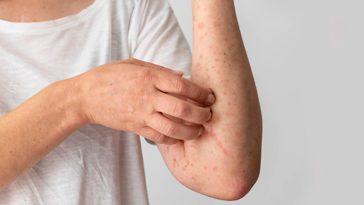 Causes Of Autoimmune Diseases In Hindi
