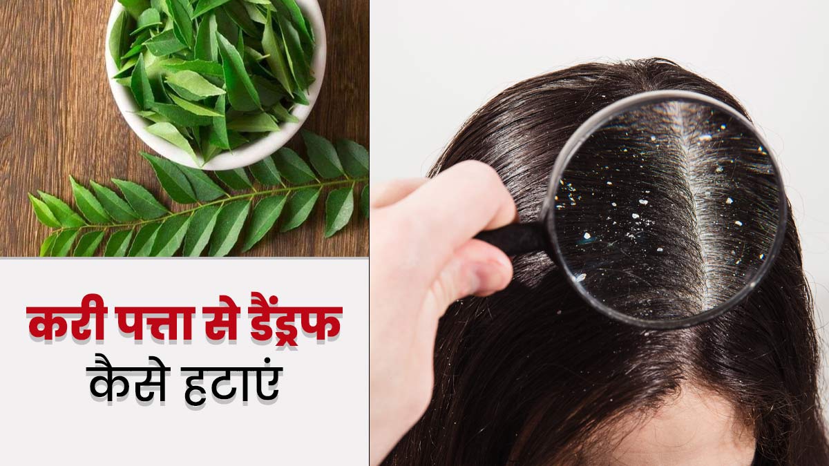 How To Use Curry Leaves For Dandruff In Hindi | करी पत्ता से डैंड्रफ कैसे  हटाएं | Kadi Patta Se Dandruff Kaise Hataye