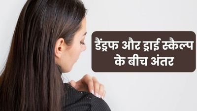 कहीं आप स्कैल्प के रूखेपन को डैंड्रफ तो नहीं समझ रहे? ऐसे पहचानें दोनों में अंतर