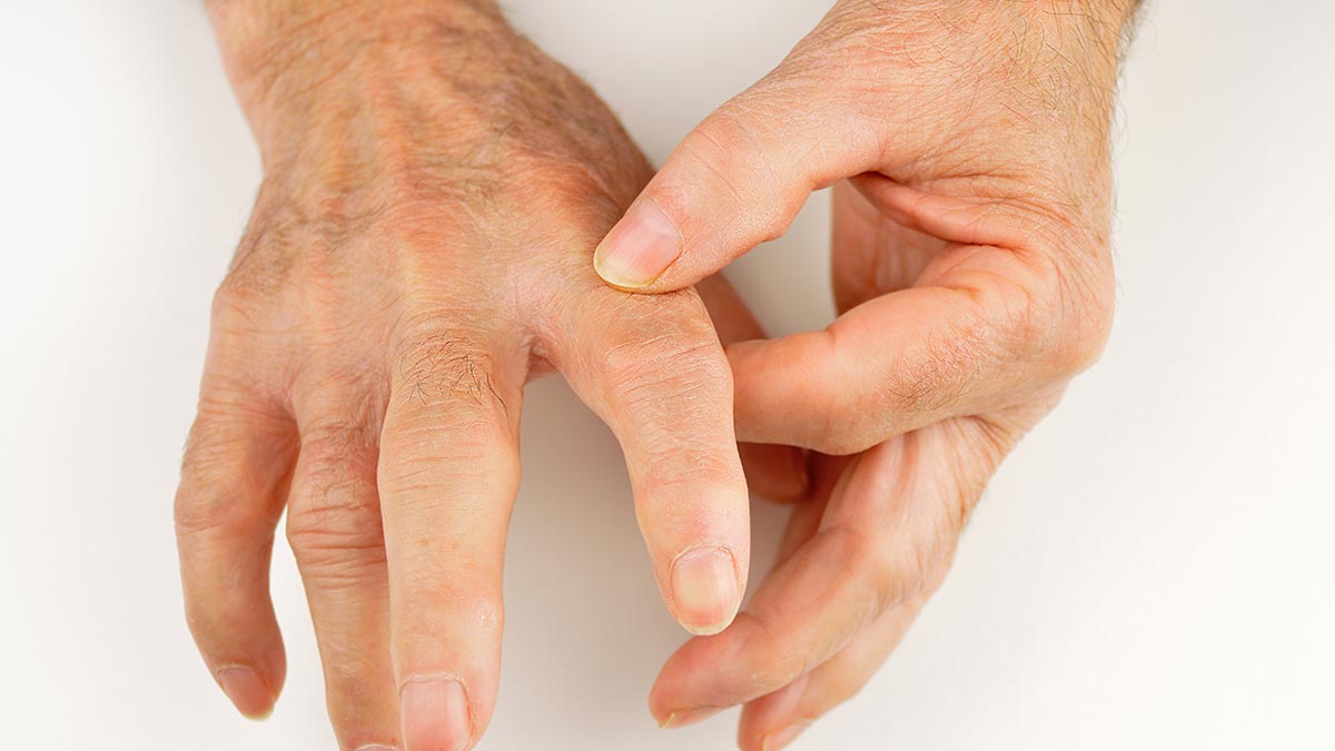 finger fracture symptoms