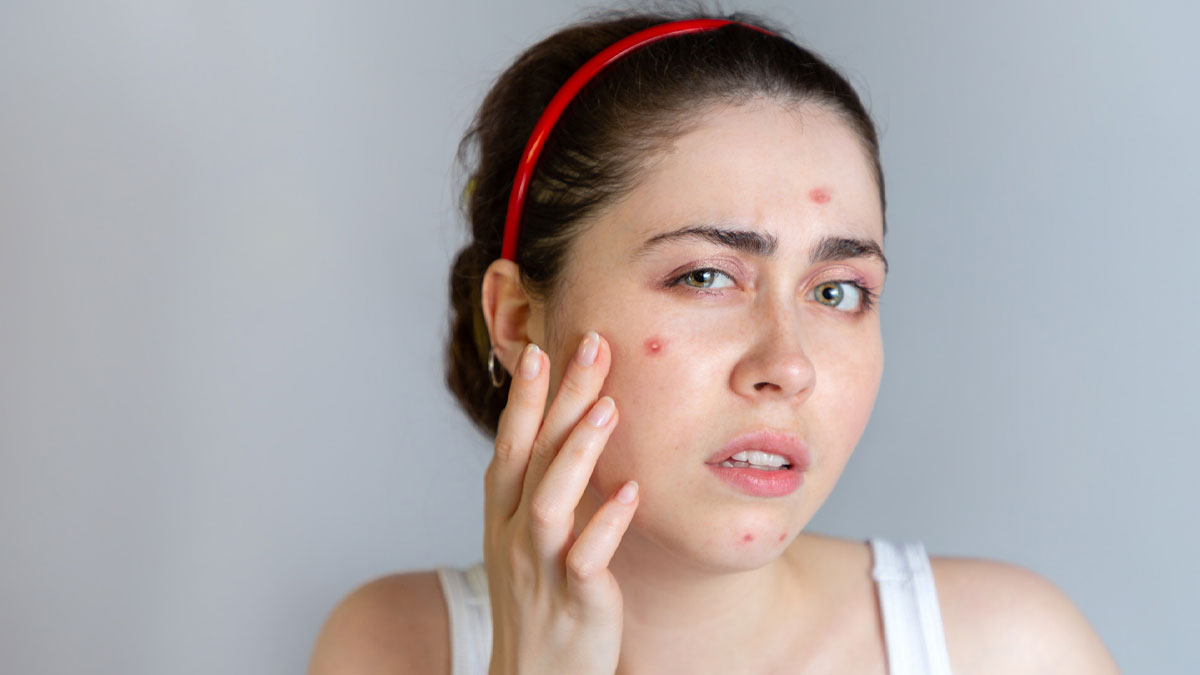 Face-Par-Olive-Oil-Ke-Nuksan