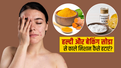 हल्दी और बेकिंग सोडा से चेहरे के काले धब्बे कैसे हटाएं? जानें 3 तरीके और पाएं निखरी त्वचा 
