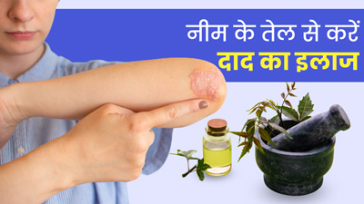 दाद होने पर इस तरह लगाएं नीम का तेल, दूर होगी समस्या