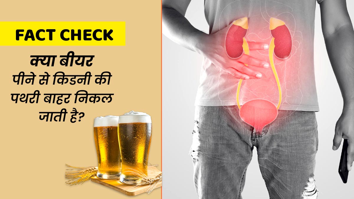Fact Check: क्या बीयर पीने से किडनी की पथरी बाहर निकल जाती है? डॉक्टर से जानें इस दावे की सच्चाई