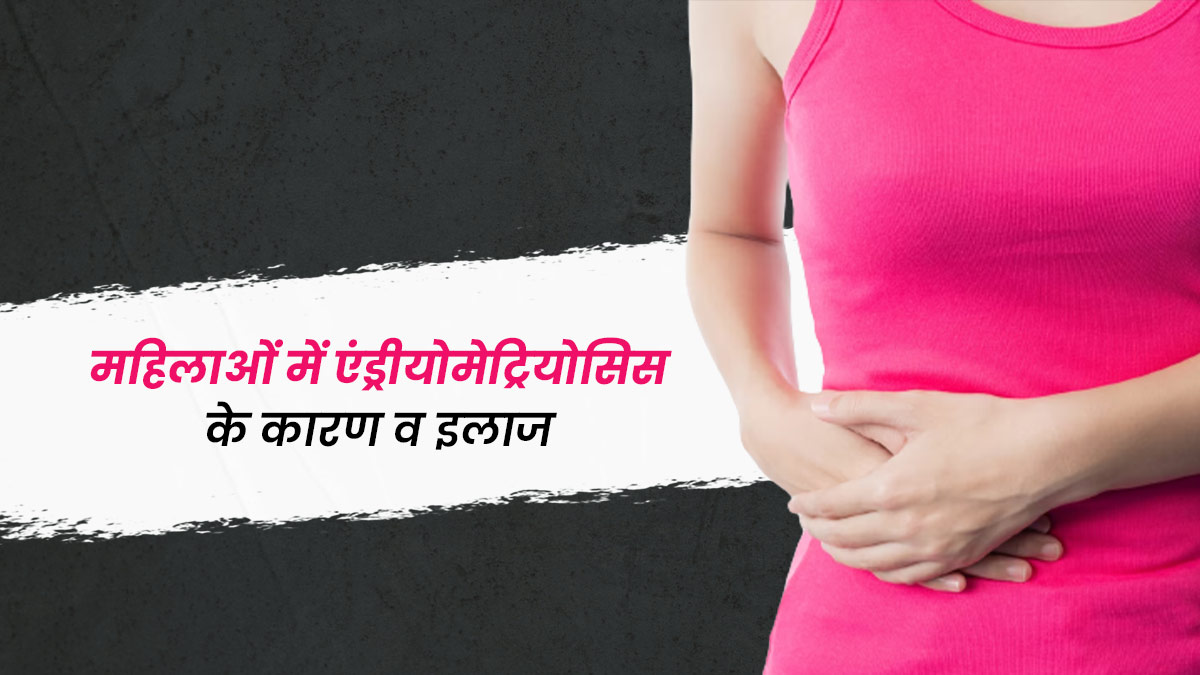 महिलाओं को एंडोमेट्रियोसिस की समस्या क्यों होती है? डॉक्टर से जानें इसका कारण और इलाज
