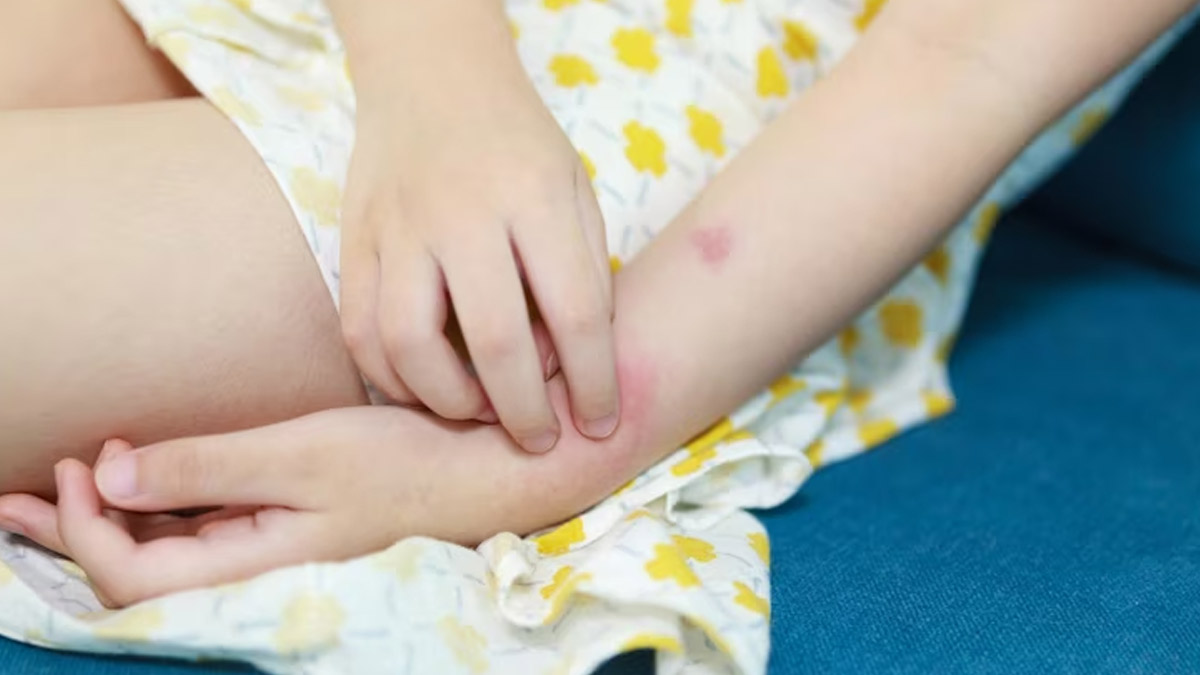 Food Items That May Cause Allergy In Children