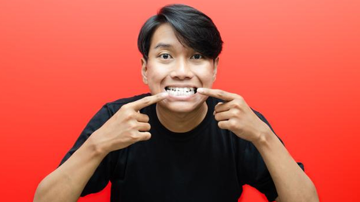 Dentist Explains Rare Teeth Disorders Everyone Should Know
