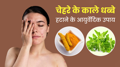 चेहरे के काले धब्बों (डार्क स्पॉट्स) से छुटकारा पाने के लिए आजमाएं ये 5 आयुर्वेदिक उपाय 