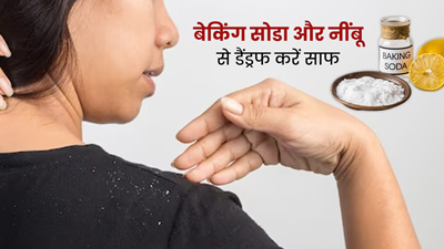 डैंड्रफ से छुटकारा पाने के लिए इस तरह करें बेकिंग सोडा और नींबू का प्रयोग, स्कैल्प की एलर्जी भी होगी दूर