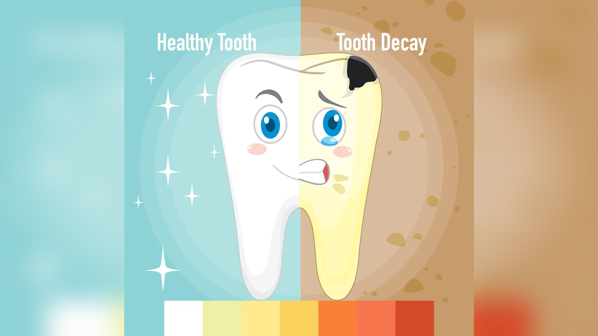 Tooth-decay