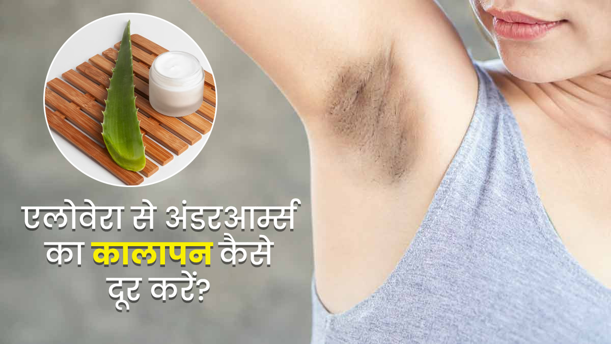 अंडरआर्म्स का कालापन दूर करने के लिए इन 4 तरीकों से करें एलोवेरा का इस्तेमाल
