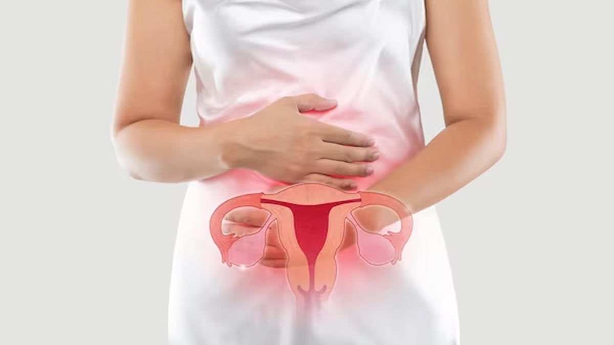 PCOS Myths And Facts In Hindi