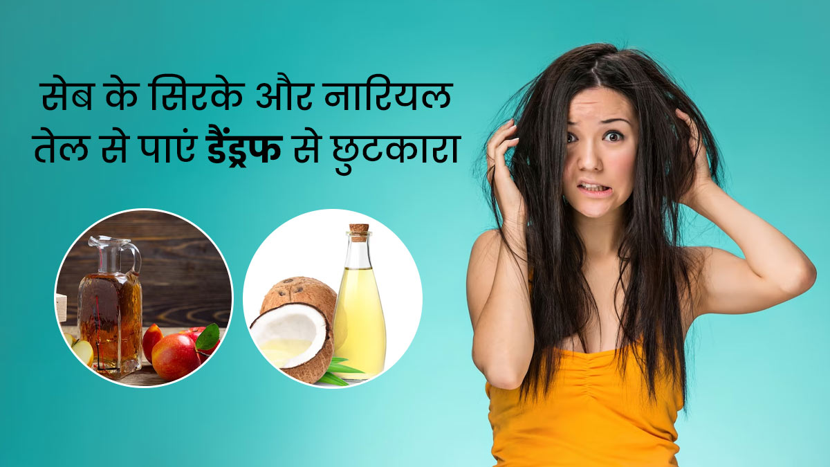 डैंड्रफ से छुटकारा दिलाएंगे सेब का सिरका और नारियल तेल, जानें इस्तेमाल का तरीका 