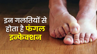 मॉनसून में इन 5 गलत‍ियों के कारण हो सकता है पैरों में फंगल इंफेक्‍शन, बरतें जरूरी सावधानियां