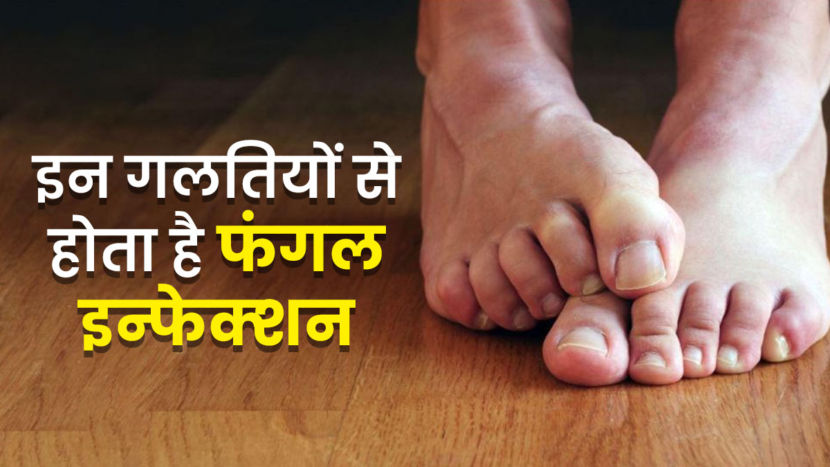 मॉनसून में इन 5 गलत‍ियों के कारण हो सकता है पैरों में फंगल इंफेक्‍शन, बरतें जरूरी सावधानियां