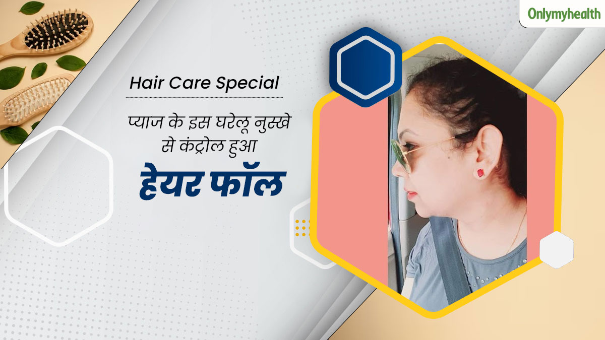 झड़ते बालों के कारण गंजेपन का शिकार होने लगी थीं हिमिका, प्याज के इस घरेलू नुस्खे से दोबारा उगने लगे बाल