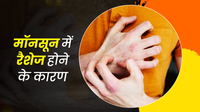 मॉनसून में इन 6 कारणों से त्वचा पर हो सकते हैं रैशेज, जरूर बरतें सावधानी