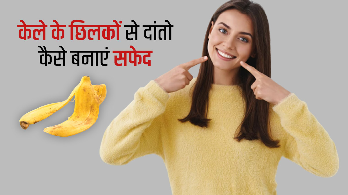 दांतों को सफेद करने में मदद करेंगे केले के छिलके, इस तरह से करें इस्तेमाल