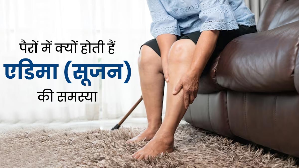 पैरों में एडिमा (सूजन) की समस्या क्यों होती है? जानें इसके 5 कारण