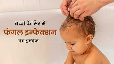 छोटे बच्चों के सिर में फंगल इंफेक्शन क्यों होता है? जानें इसके कारण और इलाज