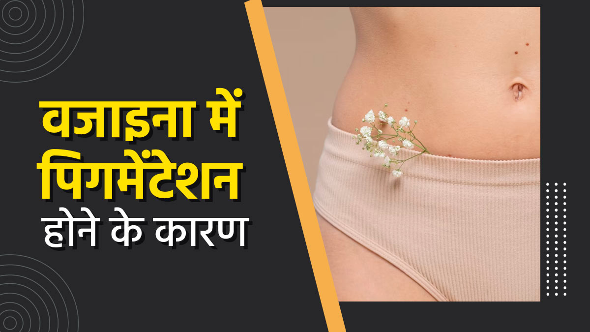 वजाइना में पिगमेंटेशन (कालापन) क्यों हो जाती है? जानें इसके 5 कारण