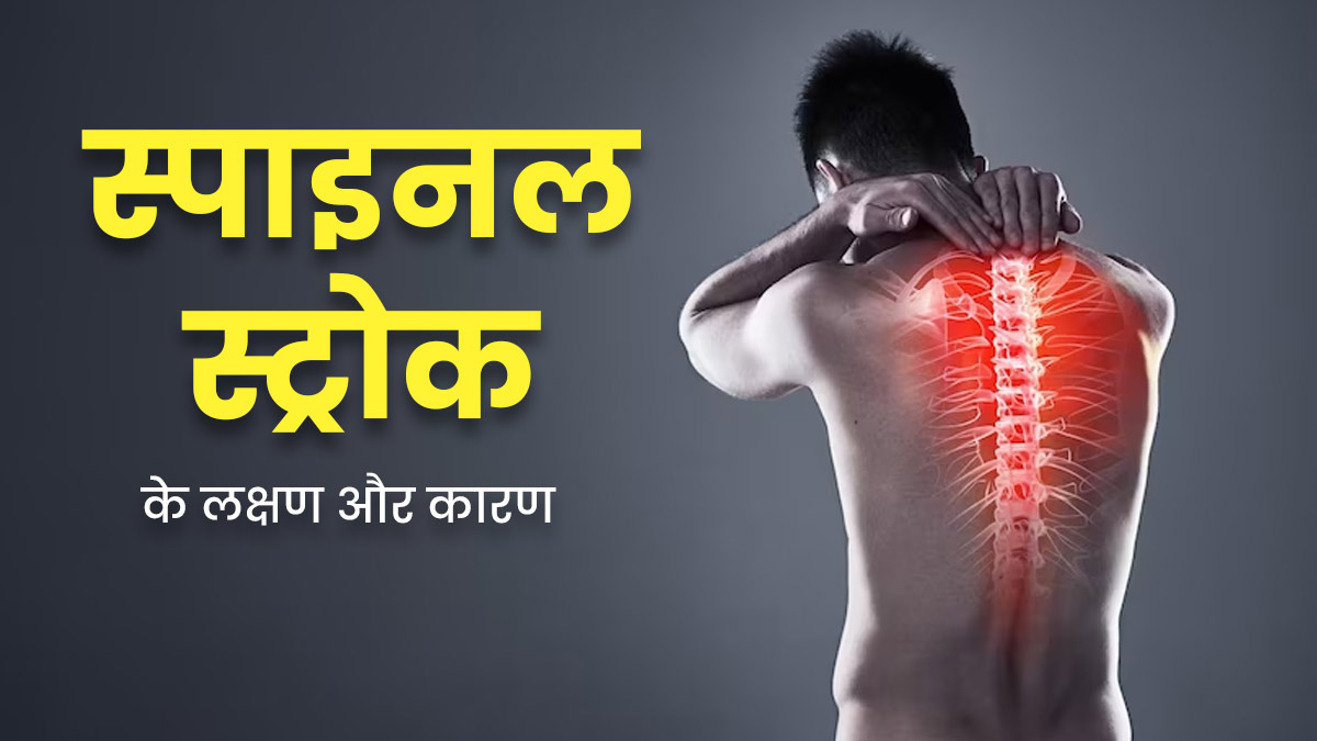 गर्दन और कमर में अचानक होने वाला दर्द हो सकता है स्पाइनल स्ट्रोक का संकेत, जानें लक्षण, कारण और इलाज 