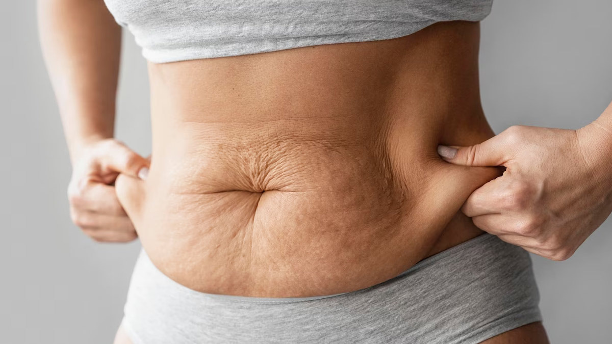 cellulitis causes in hindi