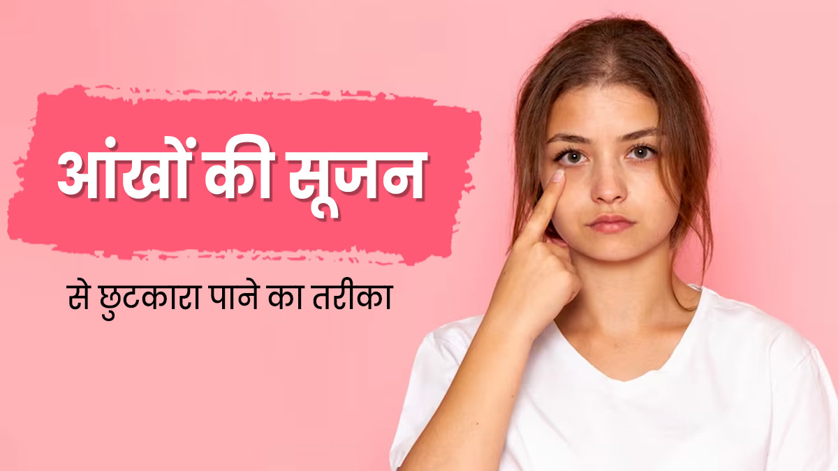 आंखों की सूजन को दूर करने के लिए अपनाएं ये 5 नेचुरल तरीके, मिलेगा आराम 