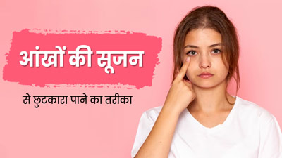 आंखों की सूजन को दूर करने के लिए अपनाएं ये 5 नेचुरल तरीके, मिलेगा आराम 