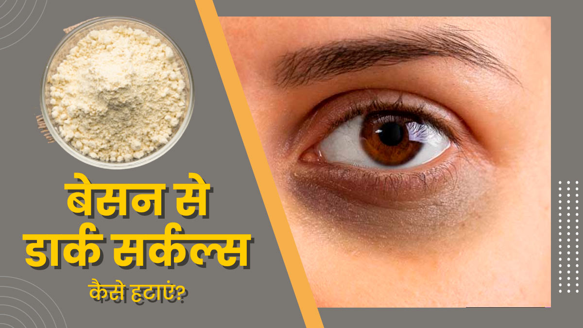 बेसन से डार्क सर्कल्स कैसे हटाएं? जानें इस्तेमाल के 4 तरीके