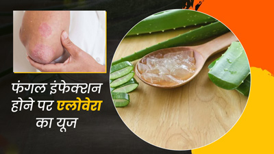 फंगल इंफेक्शन होने पर इन 4 तरीकों से करें एलोवेरा का इस्तेमाल, दूर होगी समस्या